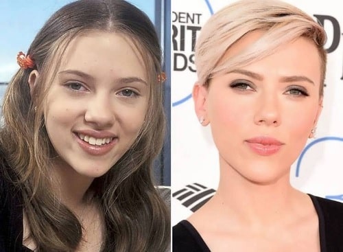 A picture of Scarlett Johansson before and after nose job.